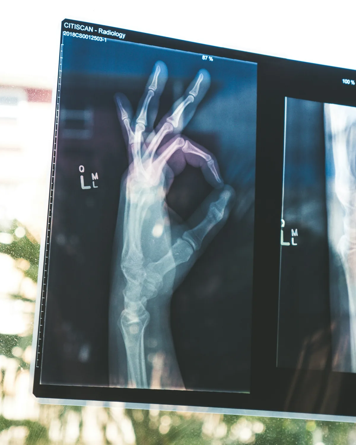 Refuah Health Center and the High Cost of HIPAA Violations: A Case for Cybersecurity Investment